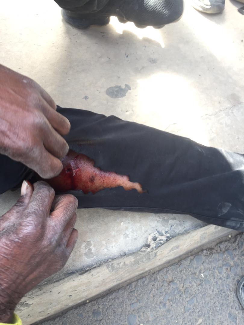 Rond-point Mermoz : Un reporter reçoit une balle à blanc à la jambe