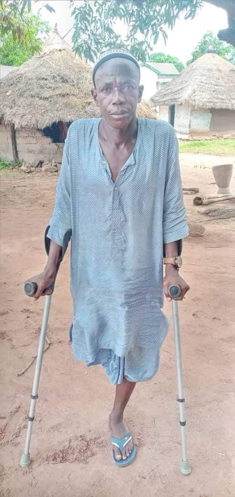 VÉLINGARA : Amputé de la jambe, Mamadou Baldé, un artiste de renom, laissé à lui-même…