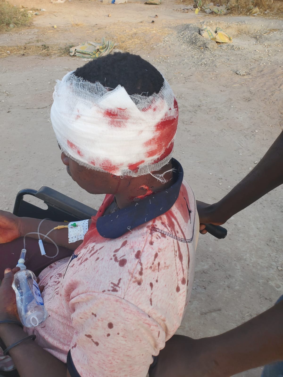 Violence électorale à Koumpentoum : des affrontements entre deux camps adverses font 2 blessés dont 1 grave.