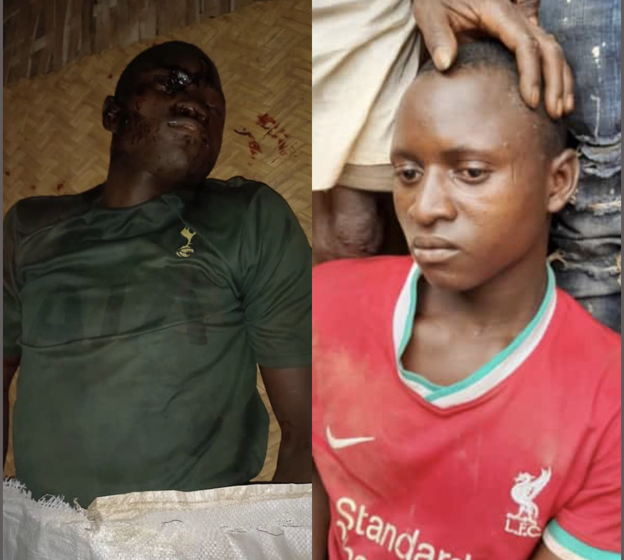 Kédougou/Drame à Daloto : après une vive altercation, il fracasse la tête de son camarade.