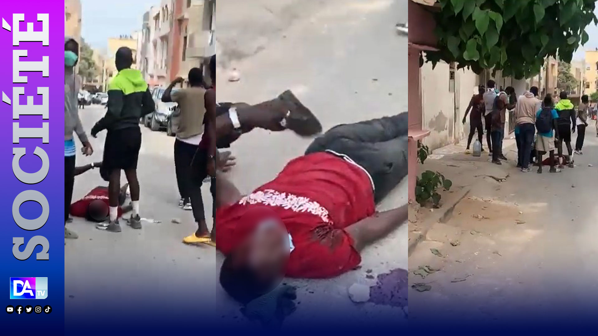 Grand Yoff : Un jeune homme touché par un projectile, en pleine tête…