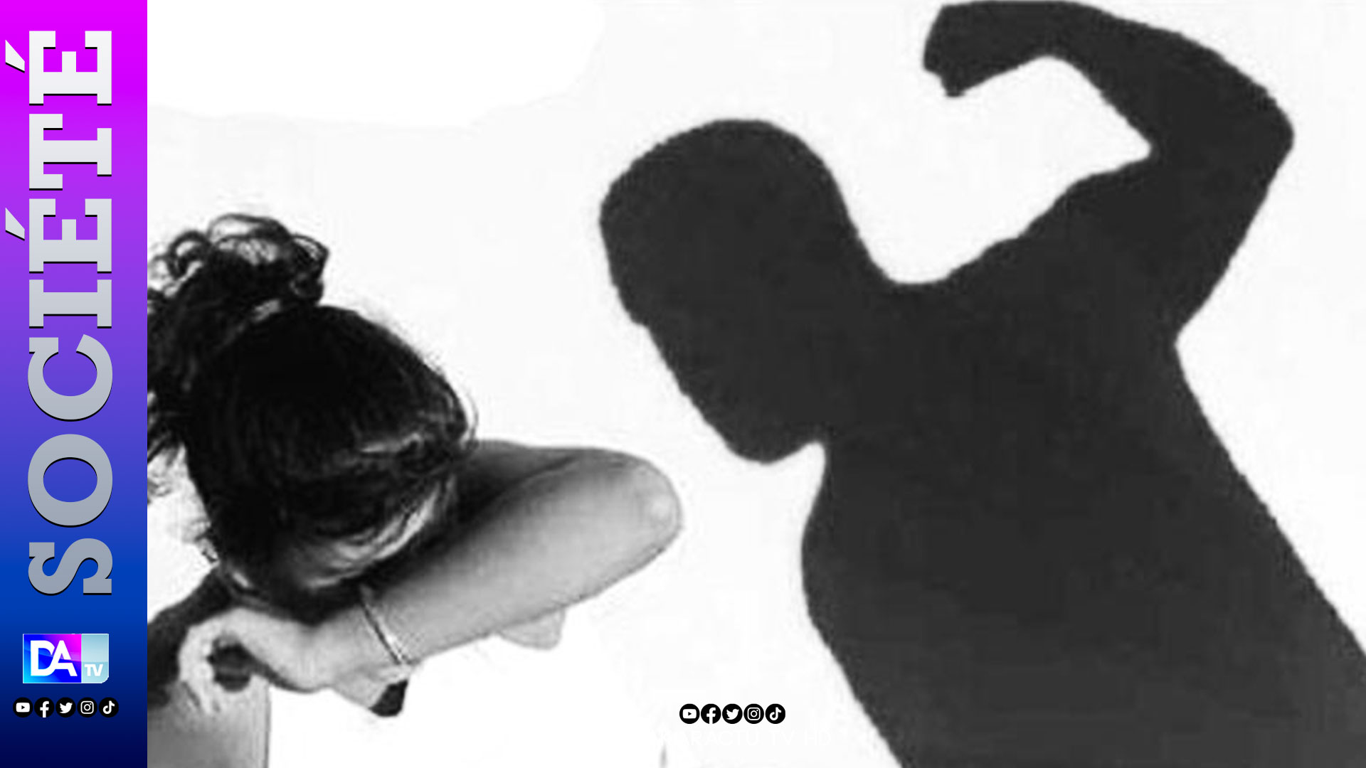 Violence conjugale : Pour une crise de jalousie, B. Ba verse du thé chaud sur le visage de son époux