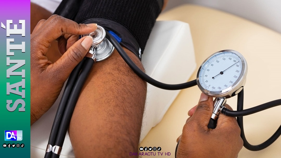 Hypertension artérielle : 600 cas notés à Ziguinchor en 2023