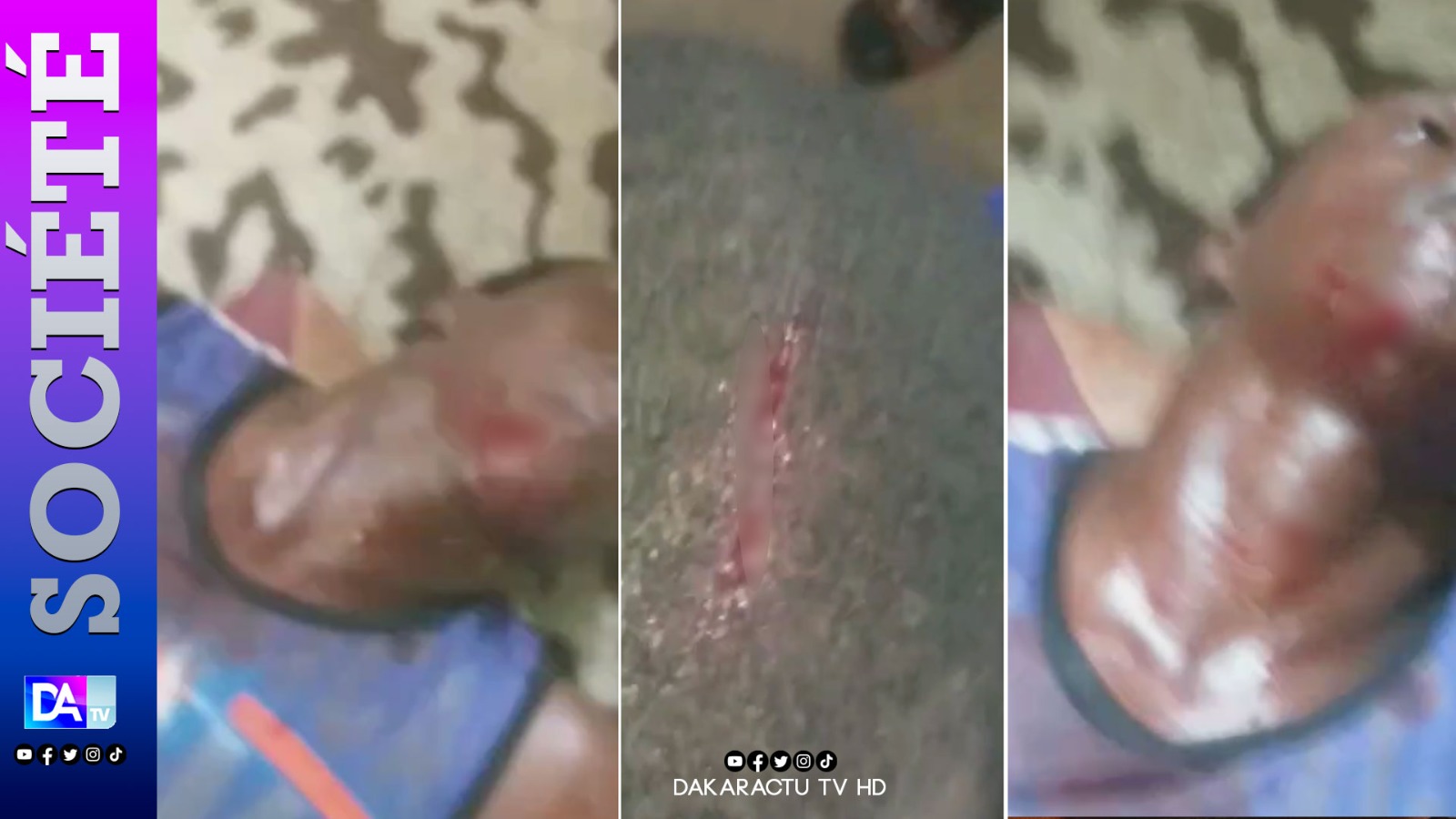 Mutinerie au Camp pénal de Liberté 6 :  Des détenus blessés  par balles à blanc...