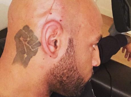 Booba crâne en sang sur Instagram, Rohff s'en mêle !