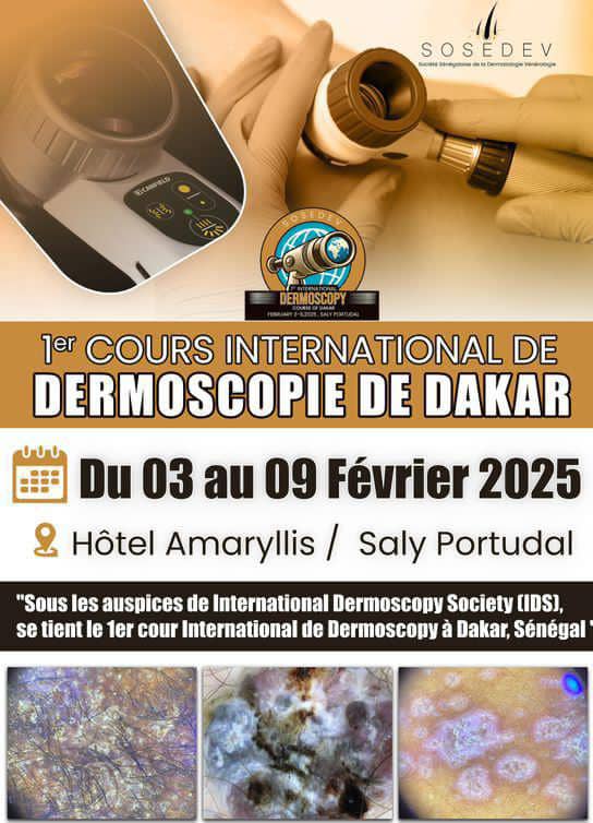 Santé : La Société Sénégalaise de Dermatologie-Vénéréologie (SOSEDEV) organise le 1er Cours International de Dermoscopie