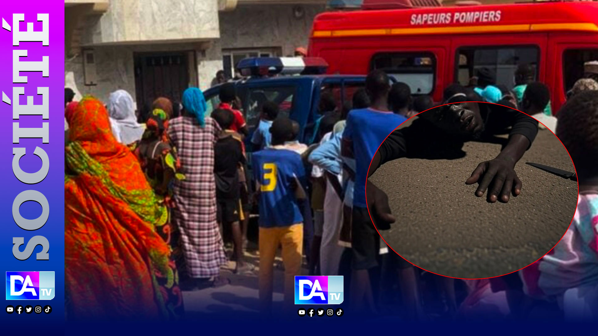 Drame sanglant à Fass Mbao: Pour 1 500 F CFA, une dette dérisoire… un ami poignardé à mort