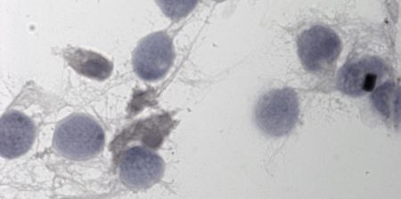 Canada : Plaintes contre une banque du sperme