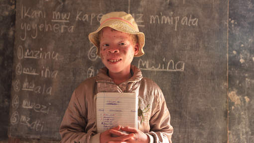 Journée internationale des albinos, minorité persécutée en Afrique