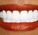 Comment rendre ses dents plus blanches naturellement ?