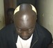 Les photos de Daddy Bibson après l'agression.