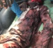 NDIOUROUL : Un adolescent tailladé à coups de machette par des bergers