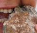 Grande-Bretagne: Cette femme mange des pierres  (VIDEO)