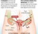 Santé / Journée Mondiale : L’Endométriose, une incommodité dans l’intimité des femmes.