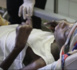 Myopathie : le calvaire des familles victimes de cette maladie rare.
