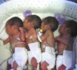 Hôpital régional de Kaolack : Une jeune maman donne naissance à des quadruplés.