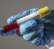 Coronavirus : les contaminations ont augmenté de 52 % en un mois dans le monde, touchant aussi le Sénégal