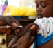 Santé: 7 cas de rougeole détectés dans la commune de Kaolack