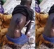 TOUBA - Un ndongo- daara maltraité, traînant une plaie horrible fracasse les âmes sensibles