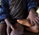 Mpox en RDC: 548 morts depuis le début de l'année
