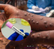 Santé-Épidémies : 463 cas confirmés de Fièvre de la Vallée du Rift et 9 cas de Mpox