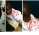 GAMBIE/Une manifestation pacifique d'opposants vire à un bain de sang : 12 blessés graves et 42 manifestants arrêtés