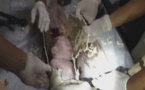 L'incroyable sauvetage d'un bébé jeté dans les toilettes