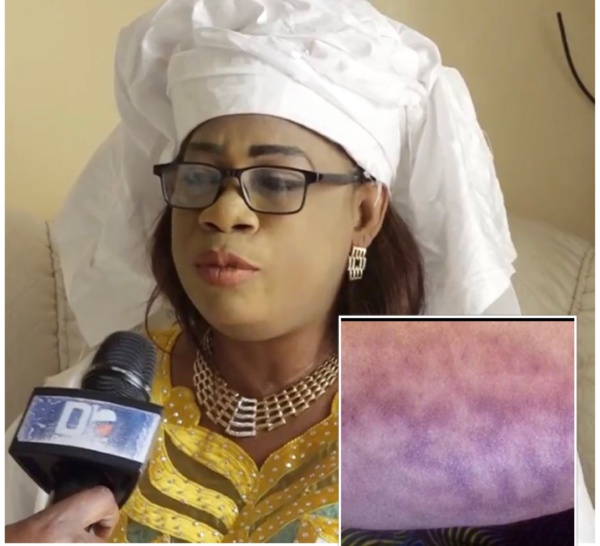 Miraculeux ! Cette voyante sénégalaise révèle l’inscription du nom d’Allah sur son corps