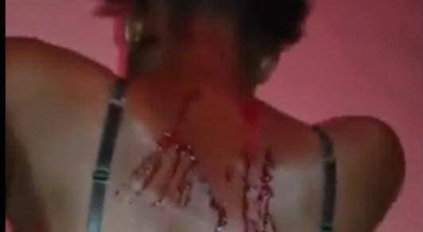 Touba : La fille violentée par son mari porte plainte
