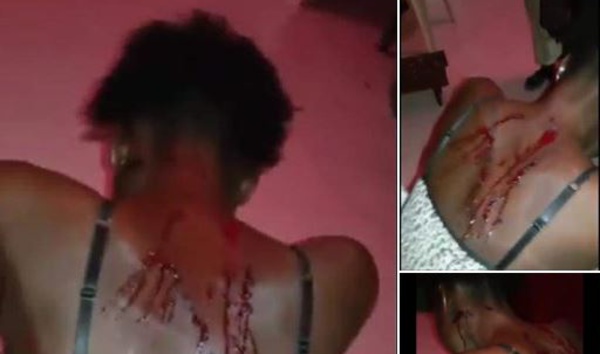 Rebondissement spectaculaire dans l’affaire de la femme battue à Touba : Ndèye Coumba retire sa plainte et pardonne à son mari