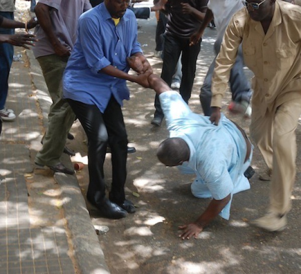 Agression d’Alioune Tine : les photos de l’horreur qui interpellent le procureur.