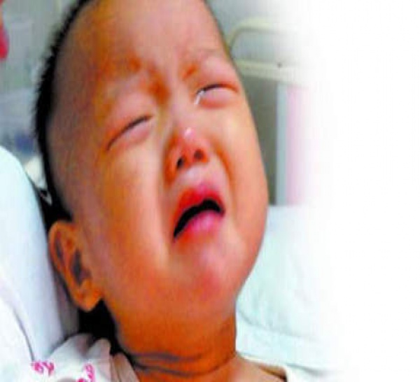 Les parents trop pauvres pour l'anesthésie, le bébé opéré sans