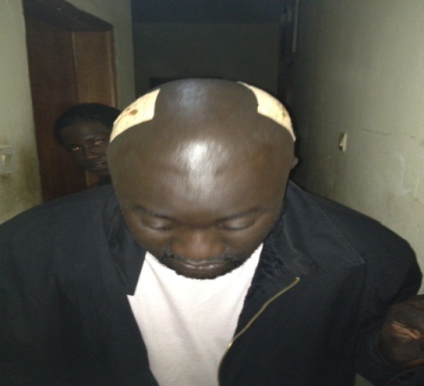 Les photos de Daddy Bibson après l'agression.