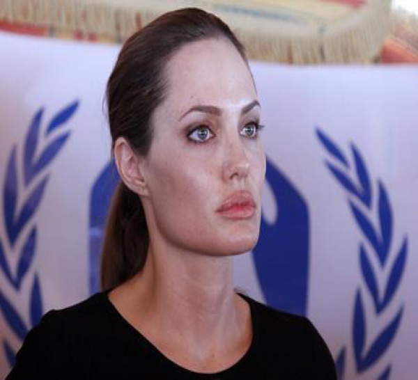 Angelina Jolie atteinte d’une étrange maladie