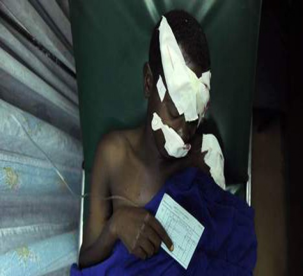 Kenya: au moins 59 morts et 200 blessés dans l'attaque des shebab  