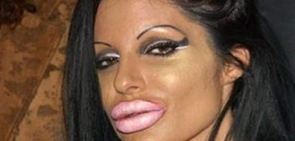 La chirurgie (in)esthétique des célébrités