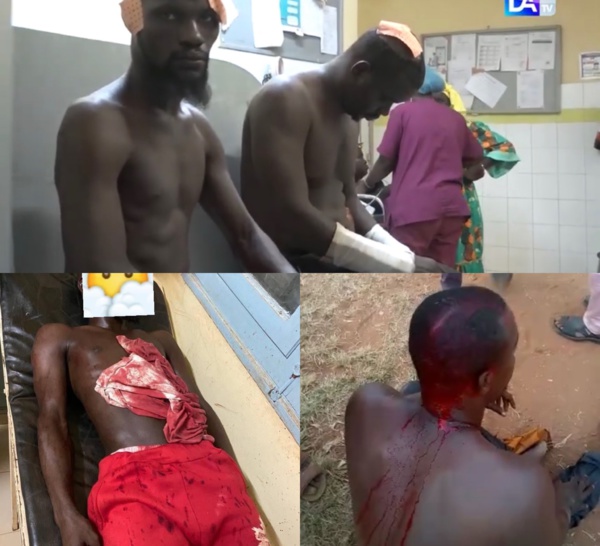 Violents affrontements à Thicky / Les témoignages  des blessés à l'hôpital de Grand Mbour : Fatou Dione annonce une plainte contre Ousmane Sonko.