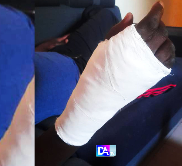 Accident de Thièyène Djiloff / Le bilan s'aggrave : 01 mort et plusieurs blessés dont 1 caméraman  de DakarActu, 1 journaliste de la Sentv et le directeur d'une radio à Mbacké