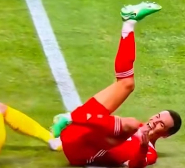 MUSIALA /  Fracture du péroné et lésions ligamentaires après un choc avec Donnarumma