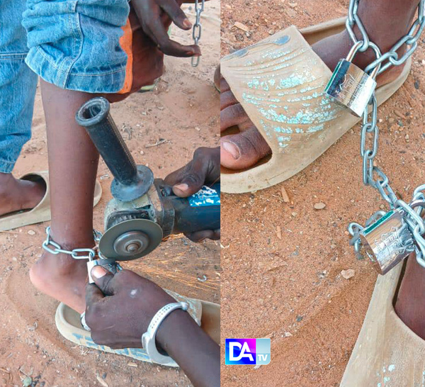 Enchaîné pour être éduqué ? Un talibé de 9 ans retrouvé les pieds liés à la Cité Apix… Son maître coranique interpellé