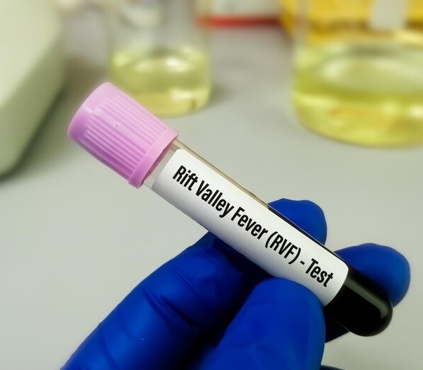 Saint-Louis : 21 cas confirmés de fièvre de la Vallée du Rift, dont 7 décès