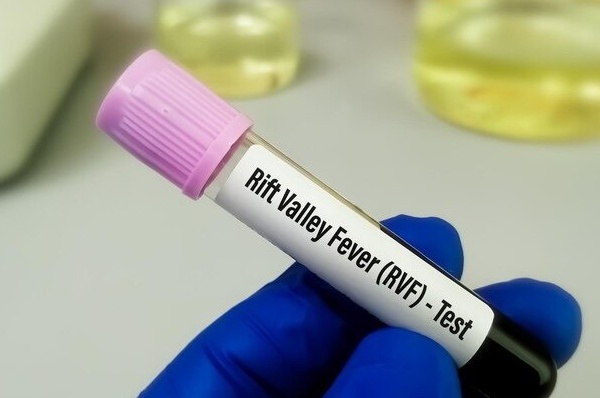 Fièvre de la vallée du Rift : Kolda enregistre son premier cas dans la commune de Kandiaye…