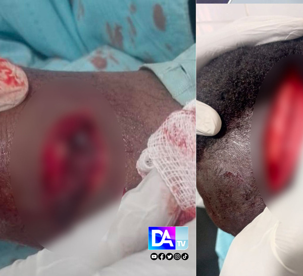 TOUBA – Un berger blesse grièvement avec une machette un maître coranique et prend la fuite.