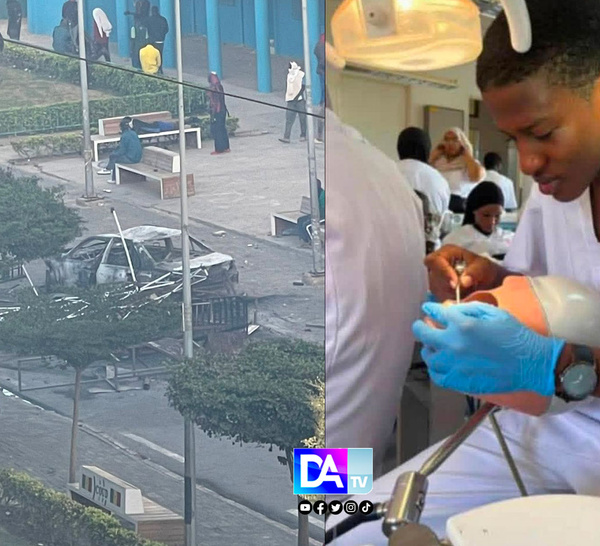 Autopsie d’Abdoulaye Ba : Des blessures multiples…les révélations médicales qui secouent le campus et relancent la polémique