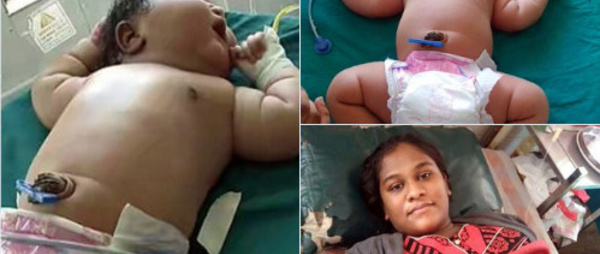 Le plus gros nouveau-né féminin du monde vient de naître en Inde ! (photo)