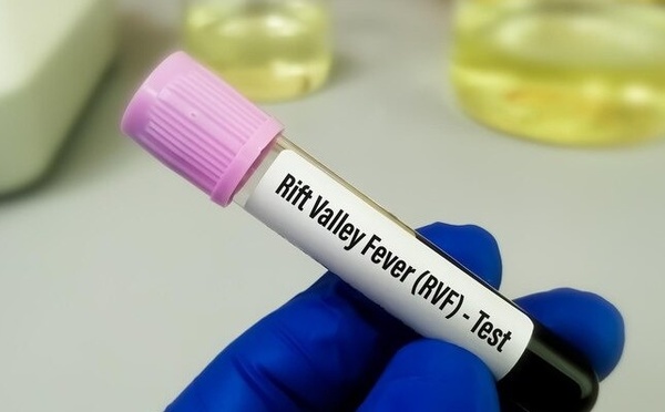 Fièvre de la Vallée du Rift: Thiès enregistre son premier cas