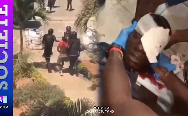 Affrontement à l'UCAD : une interpellation et un étudiant grièvement touché sèment l’émoi