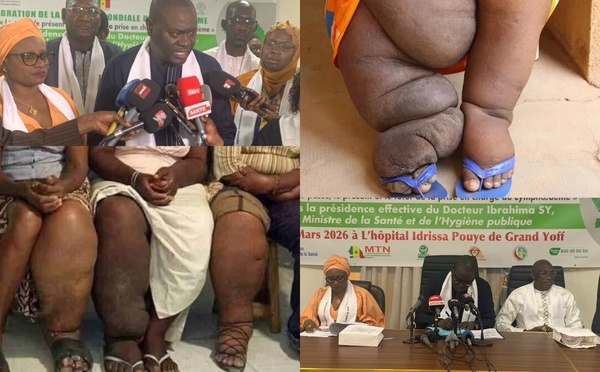 Santé : Le Sénégal célèbre une première journée mondiale du  Lymphœdème et appelle à une prise en charge accessible