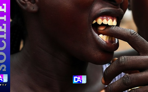 Mbour : Pour 5 000 FCFA d’électricité Woyofal, elle arrache le doigt de sa colocataire avec les dents